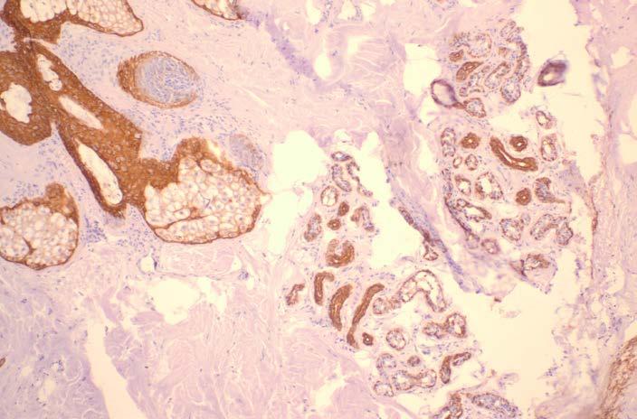 cells, sebaceous glands, out-root