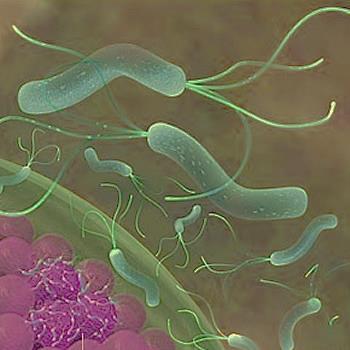 4. Helicobacter Pylori 58.4% population is infected by H. Pylori H.
