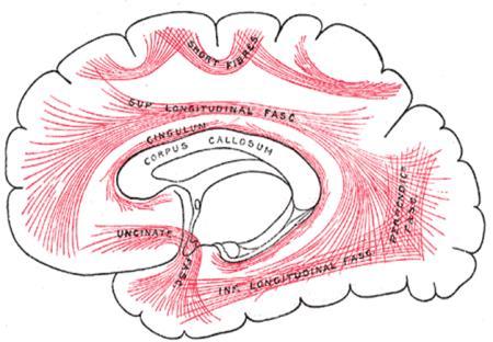 perisylvian) Visuoperceptive (occipital cortices) Visuospatial (parietal) Memory (mesial temporal)