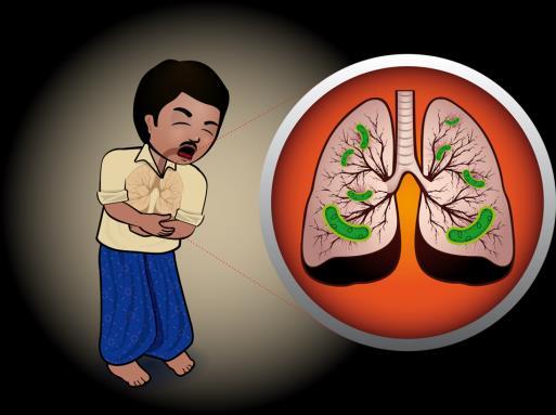 What is tuberculosis (TB)?