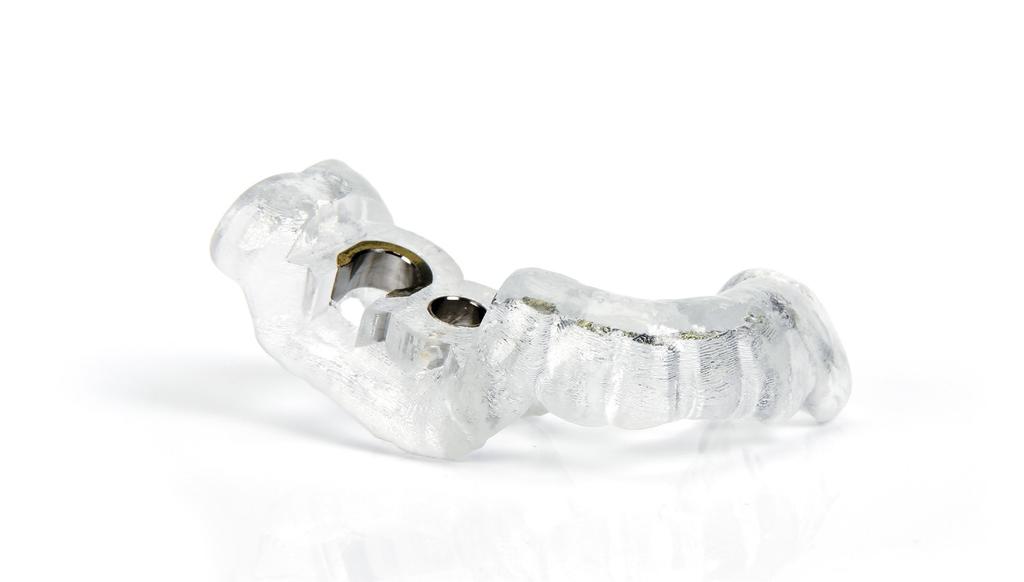 SIMPLANT the key to unlocking digital potential As part of the DENTSPLY Implants Digital Solutions portfolio, SIMPLANT digital implant treatment planning solutions allow for predictable prosthetic