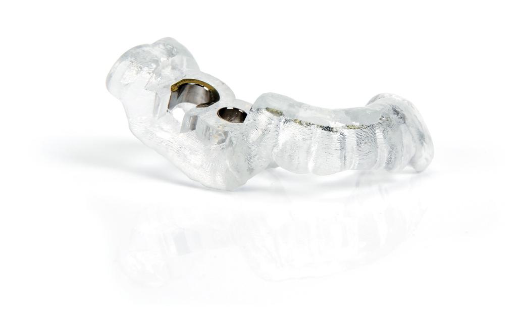Compatible with 10,000 implants from more than 100 brands 3D Comprehensive 3D communication