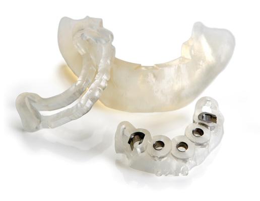 With flexible SIMPLANT Guide options, implant surgery can be performed based on your preferred technique and with precision and