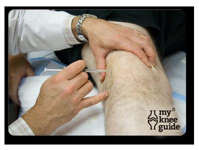 Knee Lateral Retropatellar - Keep knee straight - Palpate the