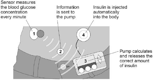 The meter reading is used to estimate how much insulin they need to inject. Figure 2 Vincente Barcel/Hemera/Thinkstock Figure 3 shows a new system.