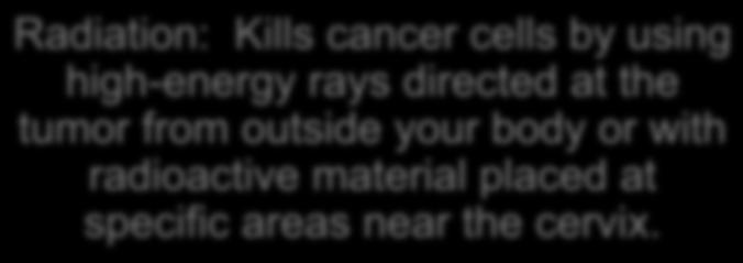 Local Treatments Radiation: Kills cancer cells by using high-energy rays directed at the tumor from outside your body or with