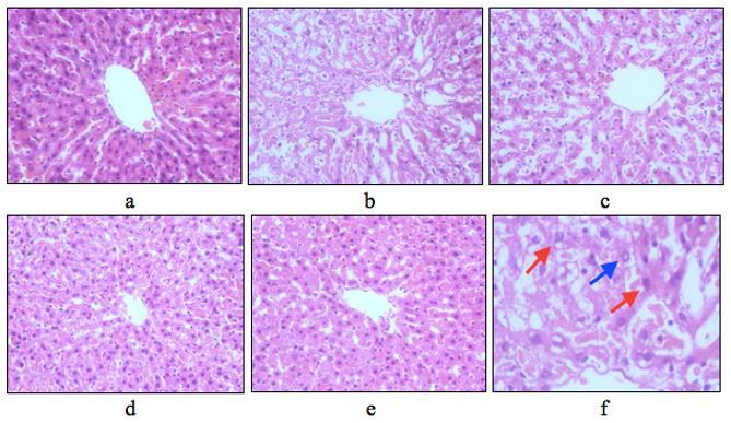 RESULTS Fatty liver percentage The histological general description of the liver in negative control group indicated normal liver histology.