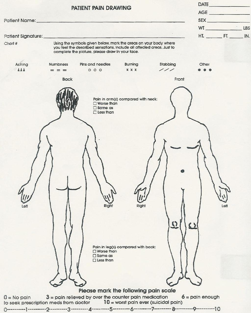 Slika 14: Grafički prikaz bola crtežom-pd (preuzeto iz