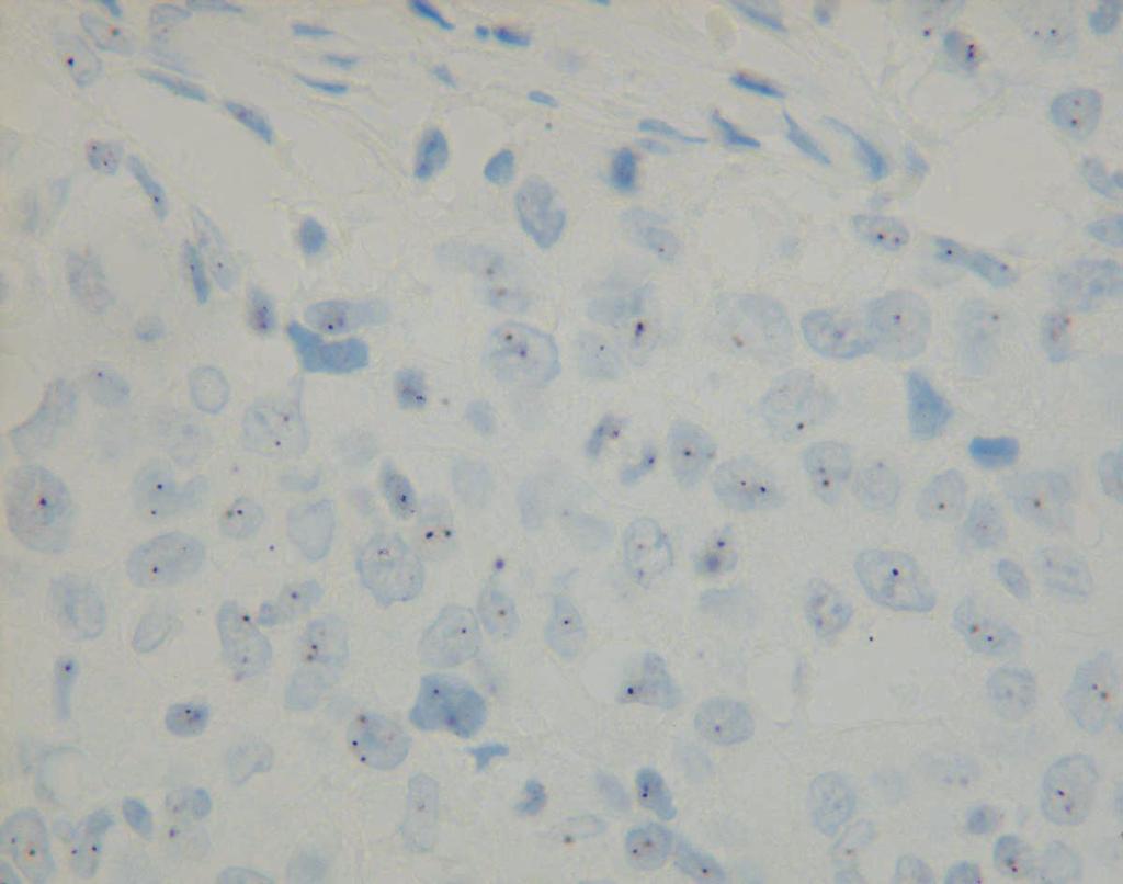 progress of proteolytic digestion by propidium iodide staining. Probe mixes were hybridized at 37 between 14 and 18 hr. After hybridizations, slides were washed in 2X SSC/0.
