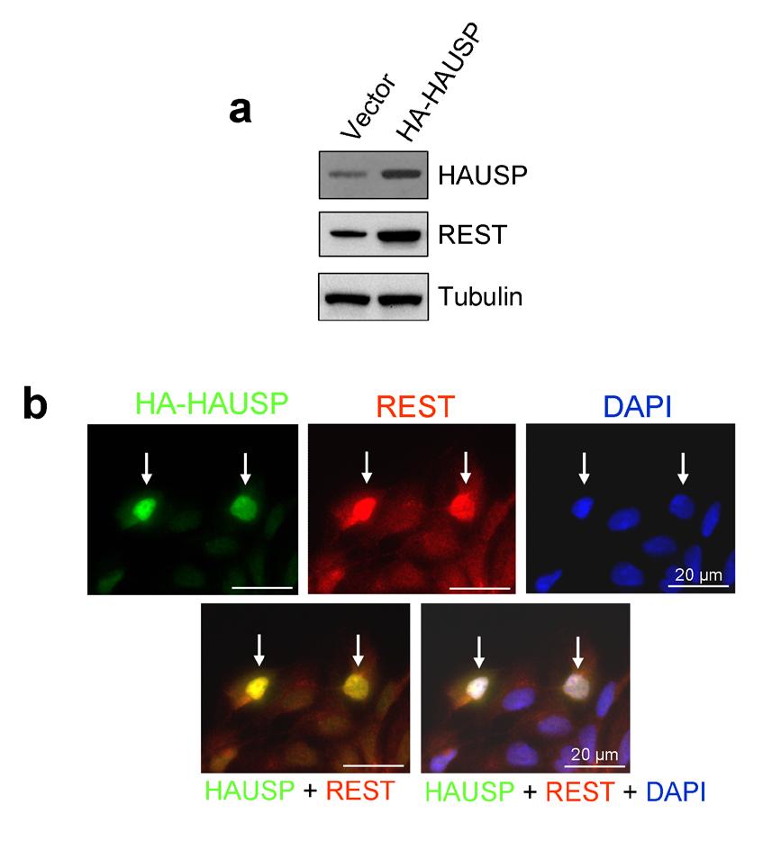 DOI: 10.1038/ncb2153 Figure S1 Ectopic expression of HAUSP up-regulates REST protein. (a) Immunoblotting showed that ectopic expression of HAUSP increased REST protein levels in ENStemA NPCs.
