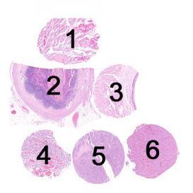 Assessment Run 34 202 Cytokeratin 9 (CK9) Material The slide to be stained for CK9 comprised:. Thyroid gland, 2. Appendix, 3. Esophagus, 4. Papillary thyroid carcinoma, 5 & 6.