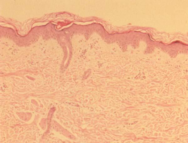 Eccrine Sweat Gland Simple coiled tubular gland Sympathetic, cholinergic innervation Duct Stratified