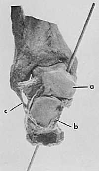 calcaneus, and forms a cone shape motion with its apex intersecting with the calcaneal attachment site