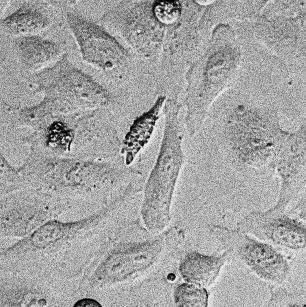 1. Expression of P2X2-Neon on GPI-YFP in HeLa cells.