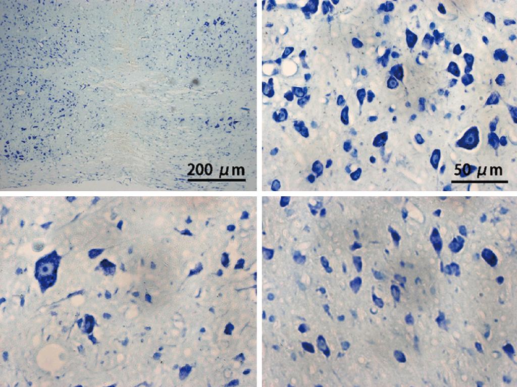 Figure 3. Nissl staining after LM22A-4 treatment. Nissl staining revealed that SCI-treated mice exhibited neuronal pyknosis and significantly reduced neuronal counts.