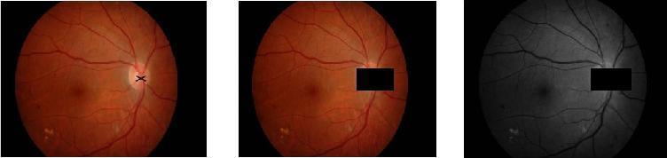 There are different ways to remove the OD. In this don t use opening for removing OD like the detection of blood vessels because opening makes blur exudates.