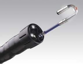 2014 Retroscope flexible catheter with
