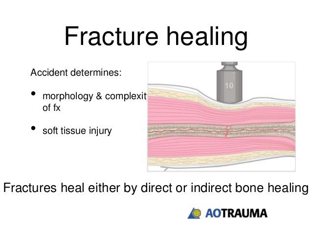 Clinical Reasoning for Fracture Management AO:
