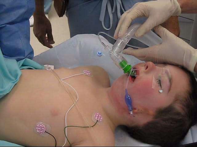 Supraglottic airway & the difficult airway SGA s: Possible to manage the difficult airway patient with SGA alone