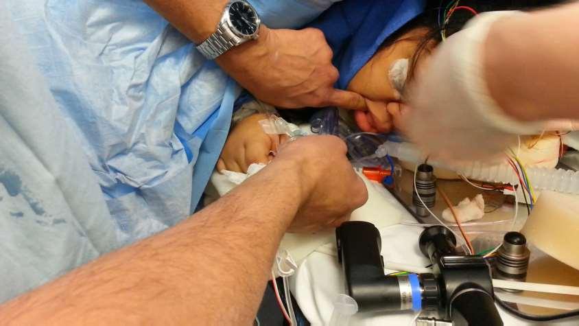 SGA for airway rescue: Prone difficult airway during spinal