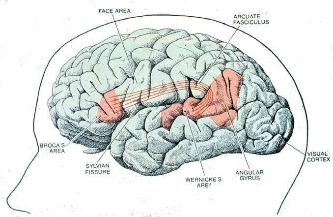 Scientific American, Freeman Press. C. Two major types of Aphasia result from strokes in dominant hemisphere. 1.