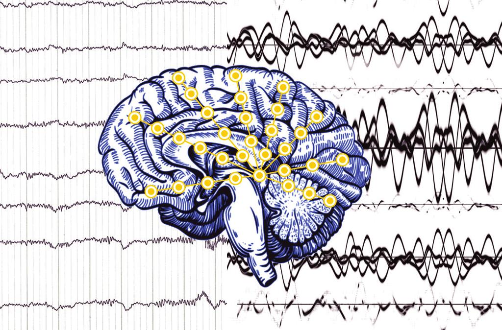 WHAT IS EPILEPSY? Epilepsy is n illness chrcterized by repeted seizures. Norml EEG EEG during generlized seizure Often, doctors cn t identify specific reson why person hs epilepsy.