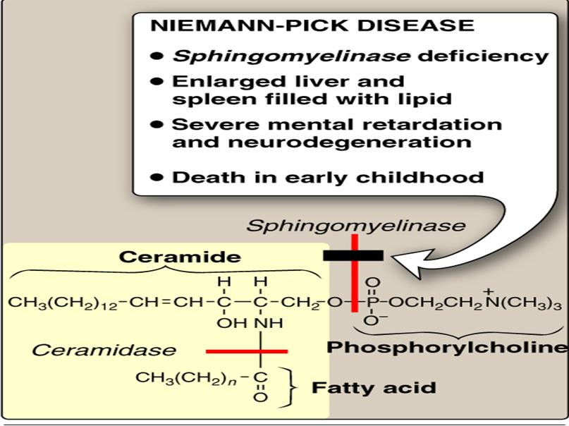 Niemann-Pick disease: is an autosomal recessive disease caused by the inability to degrade sphingomyelin.