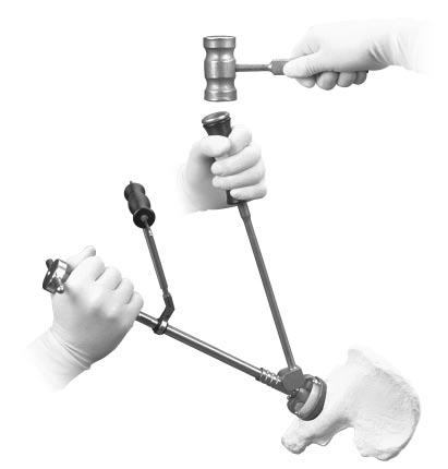 previously made on the bone. Place the Medial Cup Impactor against the Adapter.