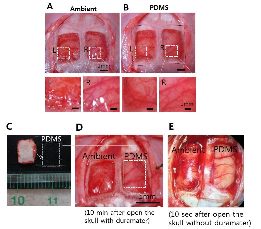 Supplementary Fig. S6 Effectiveness of PDMS in enhancing the optical (A-B) and physiological (C- E) condition in acute open skull experiments.