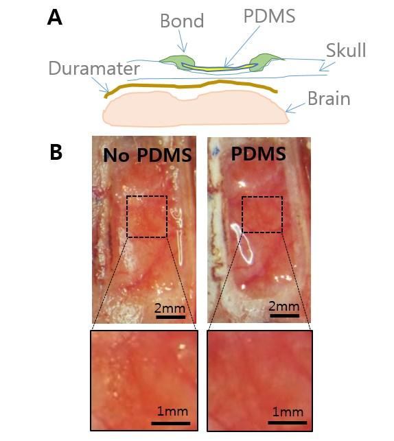 Supplementary Fig. S7 Effectiveness of PDMS for enhancing imaging quality in a thinned skull experiment. (A) A side-view schematic diagram of PDMS implantation over the thinned skull.