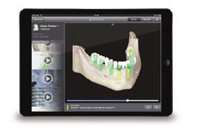 12 I codiagnostix DWOS Connect The powerful and flexible network in digital dentistry Connecting clinics, labs, production centers and other collaborators in a powerful network that leverages their