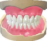 25 I DWOS DWOS Full Dentures Included in Synergy pack.
