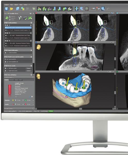 7 I codiagnostix Predictable Reliable Consistent 20 Years of clinical success 250,000+ Guided cases codiagnostix is the intuitive and easy-touse digital solution for