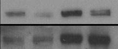 U3-1827 - + - + Fulv. - - + + P- ErbB3 P-ErbB4 ErbB4 MCF7 Supplemental Figure S8. U3-1287 downregulates fulvestrant-induced ErbB4 tyrosine phosphorylation without affecting ErbB4 levels.