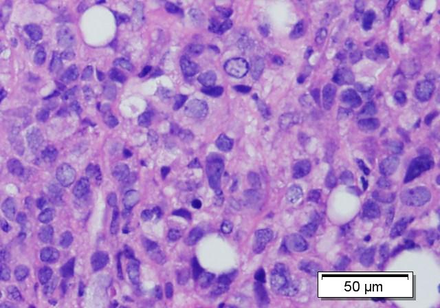 Fulv.  MDA-MB-361 tumors harvested