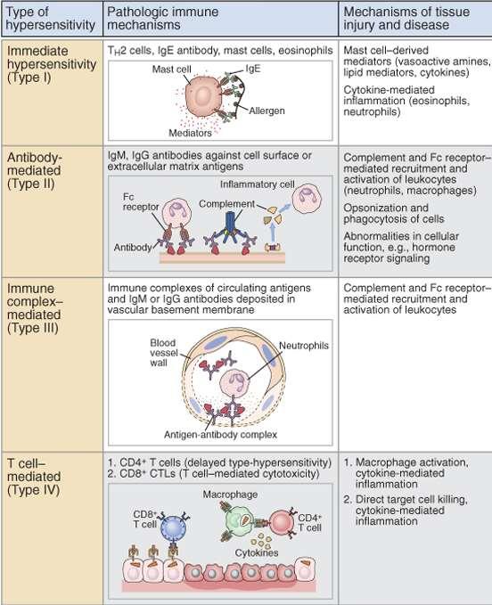 Overview of Hypersensitivity