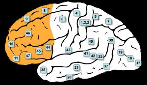 The pre-frontal cortex Problems with the pre-frontal cortex: