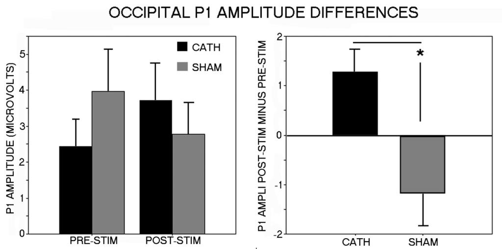 Figure 5. Occipital P1 amplitude comparisons between cathodal and sham stimulation. (Left) Pre-stimulation and post-stimulation comparisons.