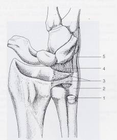 Triangular Fibro Cartilage Complex. 1. ECU tendon 2.