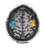 Neural correlates of