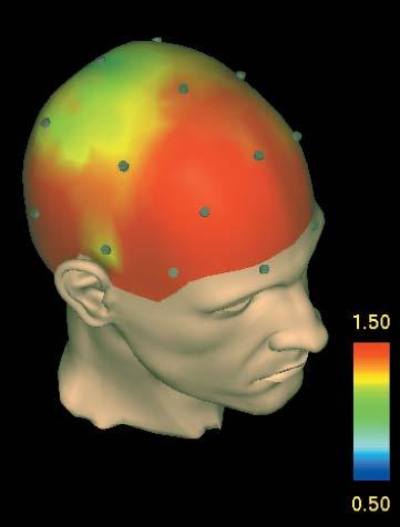 Neural correlates of lucid dreaming 40 Hz gamma power