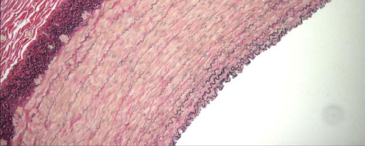 The control image shows the three layer structure of the artery, the waviness of the collagen fibers and straight elastin fibers.