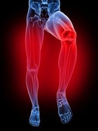 DDx: Acute Thigh Pain Fracture 2/2 osteoporosis, Vit D def, trauma, etc Ligament sprain, muscle strain DVT, thrombophlebitis