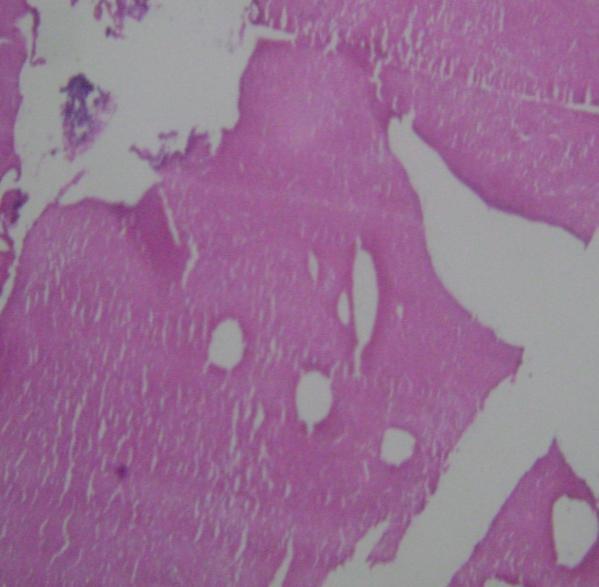 Figure 4: Decalcified section showing tubular dentine (10X, H&E) Discussion Paul broca was the first person to use the term