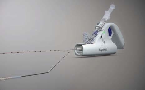 The Catheter Assembly is connected to the Motor Drive Unit (MDU). 3.