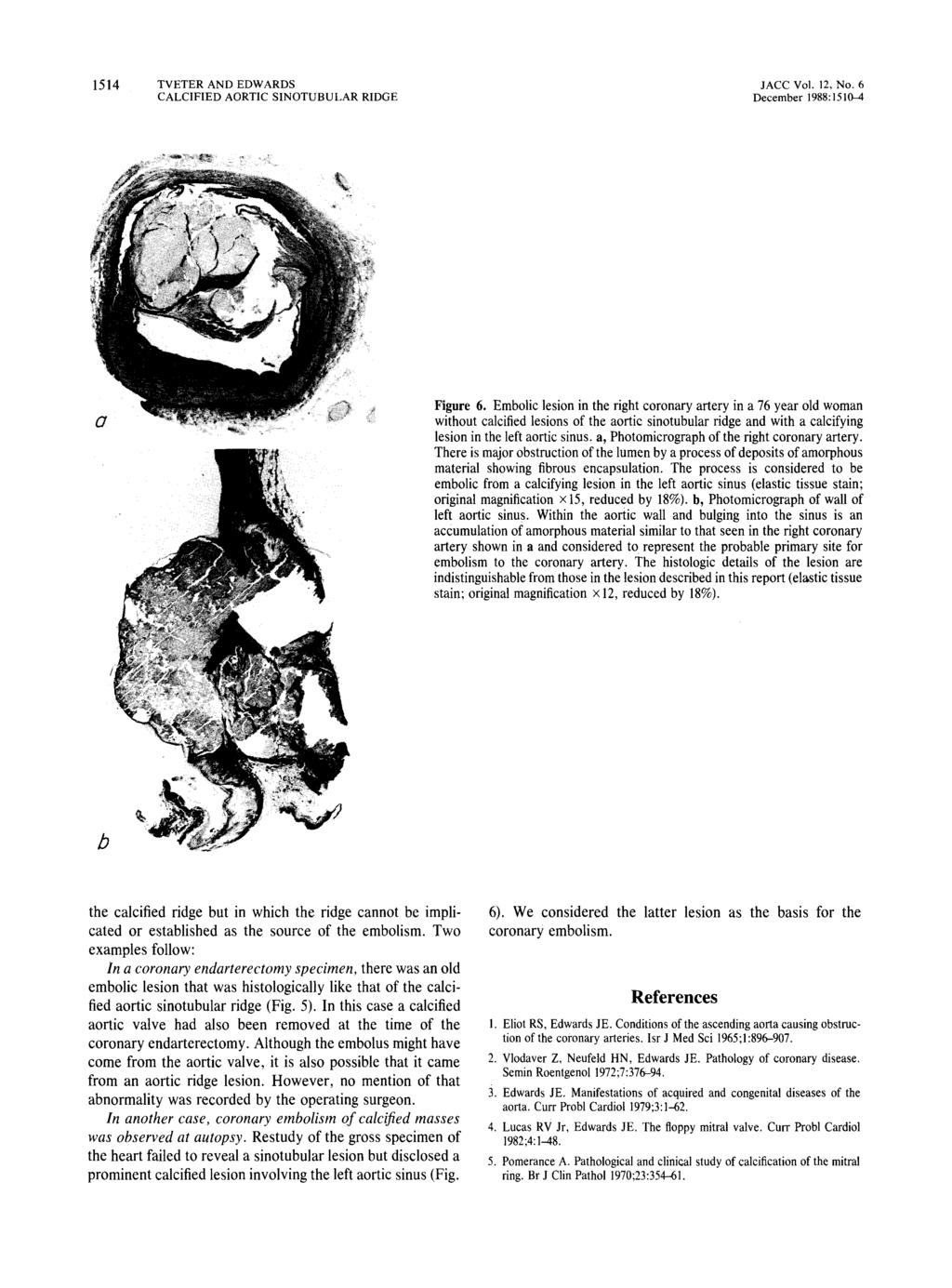 ITUBULAR RIDGE JACe Vol. 12, No.6 December 1988:1510-4 Figure 6.
