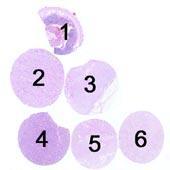Assessment Run 3 011 Epithelial cell-cell adhesion molecule (Ep-CAM) Material The slide to be stained for Ep-CAM comprised: 1. Appendix,. Kidney, 3. Adrenal gland, 4. Lung carcinoid, 5 & 6.