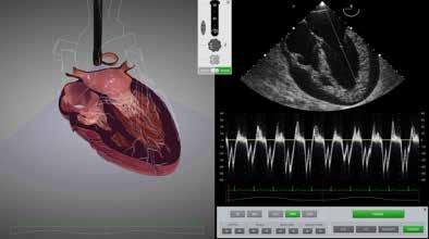 Learn Imaging Skills... ScanTrainer Probe Manipulation Skills Module Doctors can learn probe manipulation skills and how to examine complex structures.