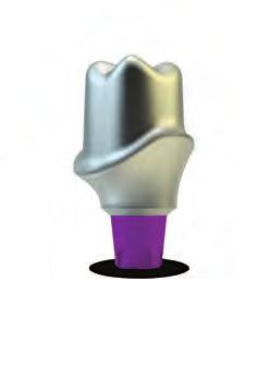 Additionally, permanent custom abutments and copings are