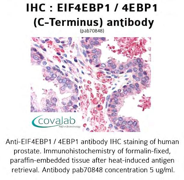 Immunohistochemistry of formalin-fixed, paraffinembedded tissue after heat-induced antigen retrieval.
